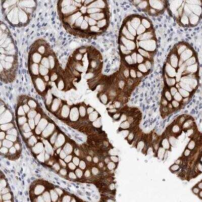 Immunohistochemistry-Paraffin CCDC28B Antibody