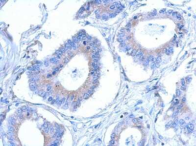 Immunohistochemistry-Paraffin CCDC28B Antibody