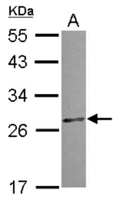 Western Blot CCDC28B Antibody