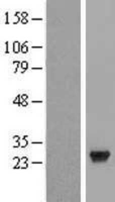 Western Blot CCDC28B Overexpression Lysate