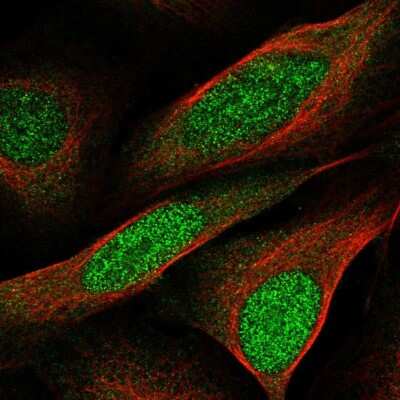 Immunocytochemistry/Immunofluorescence: CCDC3 Antibody [NBP2-56013] - Staining of human cell line U-2 OS shows localization to nucleus & cytosol. Antibody staining is shown in green.
