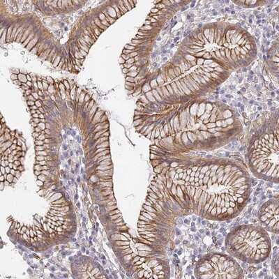 Immunohistochemistry-Paraffin: CCDC30 Antibody [NBP1-93963] - Staining of human stomach, lower shows moderate cytoplasmic and membranous positivity in glandular cells.