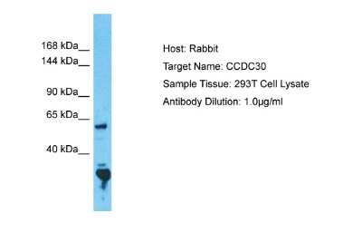 Western Blot: CCDC30 Antibody [NBP2-84608] - Host: Rabbit. Target Name: CCDC30. Sample Tissue: Human 293T Whole Cell. Antibody Dilution: 1ug/ml