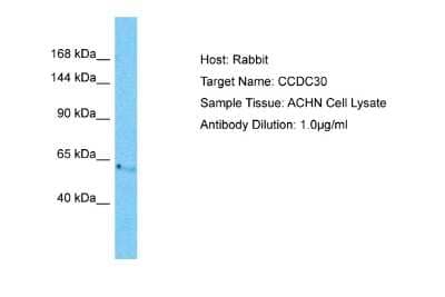 Western Blot: CCDC30 Antibody [NBP2-84609] - Host: Rabbit. Target Name: CCDC30. Sample Tissue: Human ACHN Whole Cell. Antibody Dilution: 1ug/ml