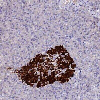 Immunohistochemistry-Paraffin: CCDC36 Antibody [NBP1-91760] - Staining of human pancreas shows strong cytoplasmic positivity in islets of Langerhans.
