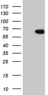 Western Blot: CCDC36 Antibody (OTI2D11) - Azide and BSA Free [NBP2-72504] - Analysis of HEK293T cells were transfected with the pCMV6-ENTRY control (Left lane) or pCMV6-ENTRY CCDC36.