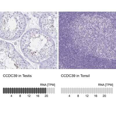 Immunohistochemistry-Paraffin CCDC39 Antibody