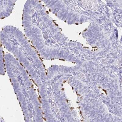 Immunohistochemistry-Paraffin CCDC39 Antibody