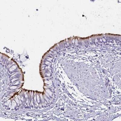 Immunohistochemistry-Paraffin: CCDC39 Antibody [NBP1-90560] - Staining of human bronchus shows strong positivity in cilia in glandular cells.