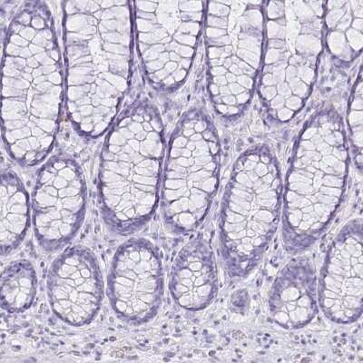 Immunohistochemistry-Paraffin: CCDC39 Antibody [NBP1-90560] - Staining of human rectum shows no positivity in glandular cells as expected.