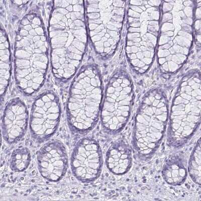 Immunohistochemistry-Paraffin: CCDC39 Antibody [NBP2-33999] - Staining of human rectum shows no positivity in glandular cells as expected.