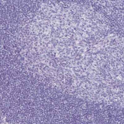 Immunohistochemistry-Paraffin: CCDC39 Antibody [NBP2-33999] - Staining of human tonsil shows no positivity in non-germinal center cells as expected.