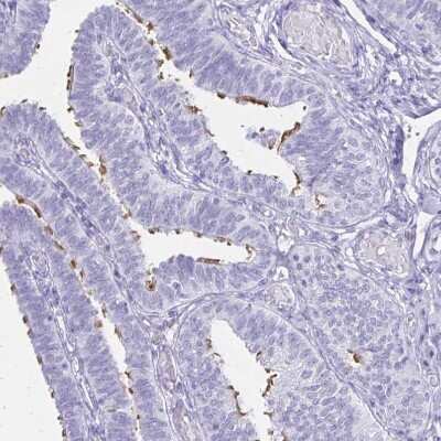 Immunohistochemistry-Paraffin: CCDC39 Antibody [NBP2-33999] - Staining of human fallopian tube shows moderate positivity in cilia in glandular cells.