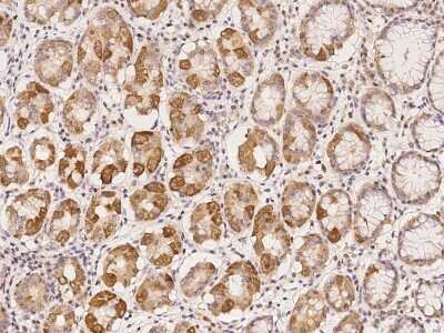 Immunohistochemistry-Paraffin: CCDC4 Antibody [NBP2-98030] - Immunochemical staining of human CCDC4 in human stomach with rabbit polyclonal antibody at 1:100 dilution, formalin-fixed paraffin embedded sections.