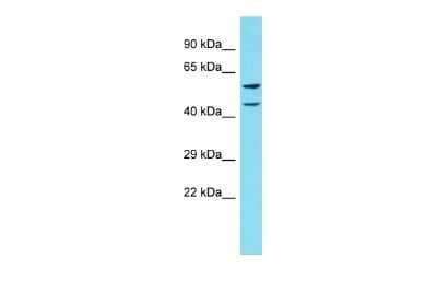 Western Blot: CCDC4 Antibody [NBP2-82588] - Host: Rabbit. Target Name: BEND4. Sample Type: 293T Whole Cell lysates. Antibody Dilution: 1.0ug/ml