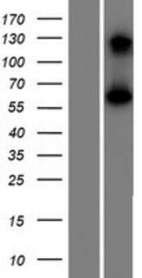 Western Blot: CCDC4 Overexpression Lysate (Adult Normal) [NBP2-04497] Left-Empty vector transfected control cell lysate (HEK293 cell lysate); Right -Over-expression Lysate for CCDC4.