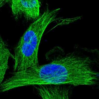 <b>Orthogonal Strategies Validation. </b>Immunocytochemistry/Immunofluorescence: CCDC40 Antibody [NBP1-82162] - Staining of human cell line U-251 MG shows localization to microtubules.