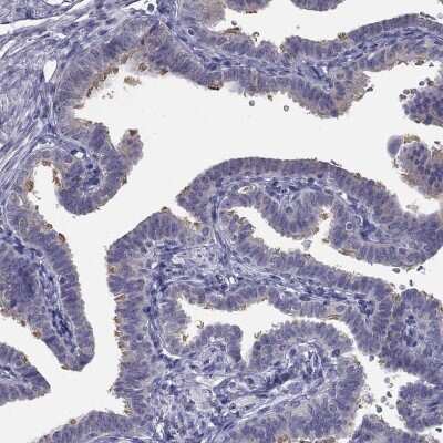 Immunohistochemistry-Paraffin: CCDC40 Antibody [NBP1-82162] - Staining of human fallopian tube shows high expression.