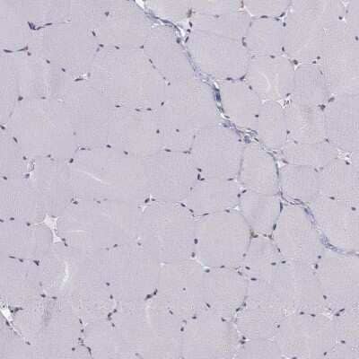 Immunohistochemistry-Paraffin: CCDC40 Antibody [NBP1-82162] - Staining of human skeletal muscle shows low expression as expected.
