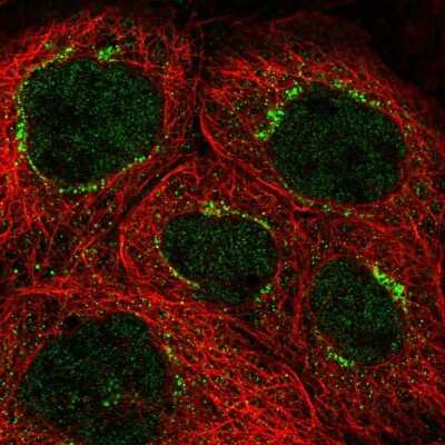 Immunocytochemistry/Immunofluorescence: CCDC41 Antibody [NBP1-90690] - Staining of human cell line A-431 shows positivity in nucleus and golgi apparatus. Antibody staining is shown in green. 