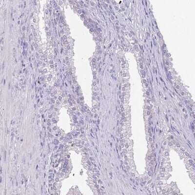 Immunohistochemistry-Paraffin: CCDC42B Antibody [NBP2-14643] - Staining of human prostate shows low expression as expected.