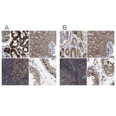 <b>Independent Antibodies Validation. </b>Immunohistochemistry-Paraffin: CCDC44 Antibody [NBP1-88160] - Staining of human kidney, liver, lymph node and testis using Anti-TACO1 antibody NBP1-88160 (A) shows similar protein distribution across tissues to independent antibody NBP1-88162 (B).