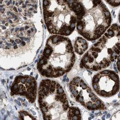 Immunohistochemistry-Paraffin: CCDC44 Antibody [NBP1-88160] - Staining of human kidney.