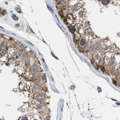 Immunohistochemistry-Paraffin: CCDC44 Antibody [NBP1-88160] - Staining of human testis.