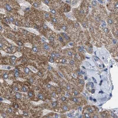 Immunohistochemistry-Paraffin: CCDC44 Antibody [NBP1-88160] - Staining of human liver.