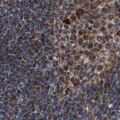Immunohistochemistry-Paraffin: CCDC44 Antibody [NBP1-88160] - Staining of human lymph node.