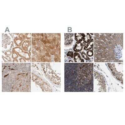 <b>Independent Antibodies Validation. </b>Immunohistochemistry-Paraffin: CCDC44 Antibody [NBP1-88161] - Staining of human kidney, liver, lymph node and testis using Anti-TACO1 antibody NBP1-88161 (A) shows similar protein distribution across tissues to independent antibody NBP1-88160 (B).