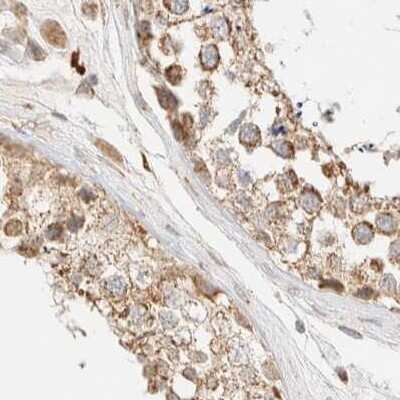 Immunohistochemistry-Paraffin: CCDC44 Antibody [NBP1-88161] - Staining of human testis.