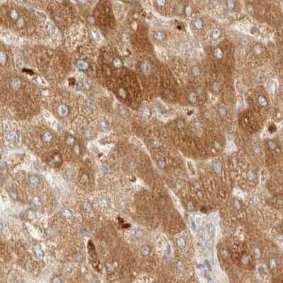 Immunohistochemistry-Paraffin: CCDC44 Antibody [NBP1-88161] - Staining of human liver.