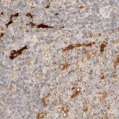 Immunohistochemistry-Paraffin: CCDC44 Antibody [NBP1-88161] - Staining of human lymph node.
