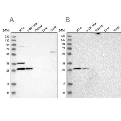 <b>Independent Antibodies Validation. </b>Western Blot: CCDC44 Antibody [NBP1-88160] - Analysis using Anti-TACO1 antibody NBP1-88160 (A) shows similar pattern to independent antibody NBP1-88162 (B).