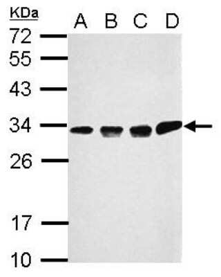 Western Blot: CCDC44 Antibody [NBP2-15749] - Sample (30 ug of whole cell lysate) A: 293T B: A431 C: HeLa D: HepG2 12% SDS PAGE gel, diluted at 1:1000.