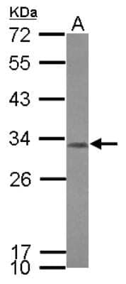 Western Blot: CCDC44 Antibody [NBP2-15750] - Sample (30 ug of whole cell lysate) A: IMR32 12% SDS PAGE gel, diluted at 1:1000.