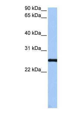 Western Blot: CCDC46 Antibody [NBP1-79545] - HepG2 cell lysate, concentration 0.2-1 ug/ml.