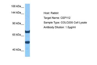 Western Blot: CCDC46 Antibody [NBP2-84612] - Host: Rabbit. Target Name: CEP112. Sample Tissue: Human COLO205 Whole Cell lysates. Antibody Dilution: 1ug/ml