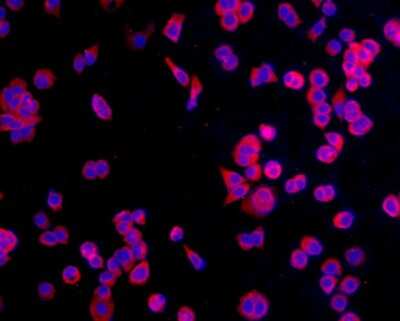 Immunocytochemistry/Immunofluorescence: CCDC47 Antibody (1-B9) [NBP2-67919] - Staining CCDC47 in MCF-7 cells (red). The nuclear counter stain is DAPI (blue). Cells were fixed in paraformaldehyde, permeabilised with 0.25% Triton X100/PBS.