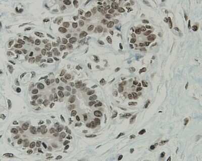 Immunohistochemistry-Paraffin: CCDC47 Antibody (1-B9) [NBP2-67919] - Analysis of paraffin-embedded human breast tissue using anti-CCDC47 antibody. Counter stained with hematoxylin.