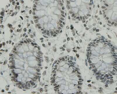 Immunohistochemistry-Paraffin: CCDC47 Antibody (1-B9) [NBP2-67919] - Analysis of paraffin-embedded human colon tissue using anti-CCDC47 antibody. Counter stained with hematoxylin.
