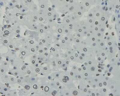 Immunohistochemistry-Paraffin: CCDC47 Antibody (1-B9) [NBP2-67919] - Analysis of paraffin-embedded human liver tissue using anti-CCDC47 antibody. Counter stained with hematoxylin.