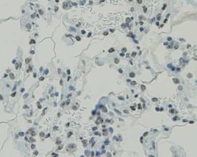 Immunohistochemistry-Paraffin: CCDC47 Antibody (1-B9) [NBP2-67919] - Analysis of paraffin-embedded human lung tissue using anti-CCDC47 antibody. Counter stained with hematoxylin.