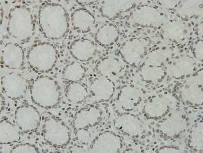 Immunohistochemistry-Paraffin: CCDC47 Antibody (1-B9) [NBP2-67919] - Analysis of paraffin-embedded human stomach tissue using anti-CCDC47 antibody. Counter stained with hematoxylin.