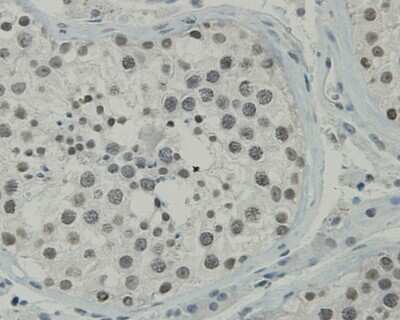 Immunohistochemistry-Paraffin: CCDC47 Antibody (1-B9) [NBP2-67919] - Analysis of paraffin-embedded human testis tissue using anti-CCDC47 antibody. Counter stained with hematoxylin.