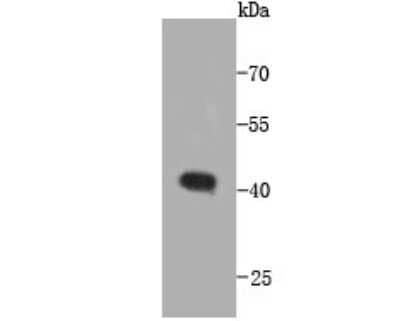 Western Blot: CCDC47 Antibody (1-B9) [NBP2-67919] - Analysis of CCDC47 on recombinant protein using anti-CCDC47 antibody at 1/1,000 dilution.