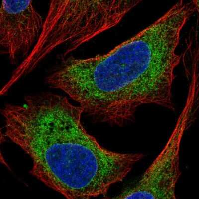 <b>Independent Antibodies Validation. </b>Immunocytochemistry/Immunofluorescence: CCDC47 Antibody [NBP2-56445] - Staining of human cell line U-2 OS shows localization to endoplasmic reticulum.