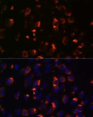 Immunocytochemistry/Immunofluorescence: CCDC47 Antibody [NBP2-92269] - Immunofluorescence analysis of C6 cells using CCDC47 antibody (NBP2-92269) at dilution of 1:100. Blue: DAPI for nuclear staining.