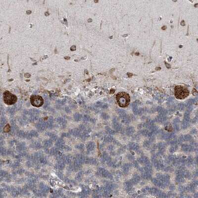 Immunohistochemistry-Paraffin: CCDC47 Antibody [NBP1-93717] - Staining of human Cerebellum shows strong granular cytoplasmic positivity in Purkinje cells.